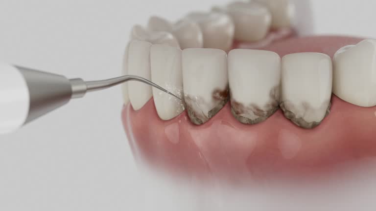 Reliable Dental Implants contractor in Leesburg, GA by Smile Center Dentistry